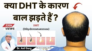 क्या DHT के कारण बाल झड़ते हैं  Do DHT Causes Hair Loss  Dr Anil Garg [upl. by Ecnarret]