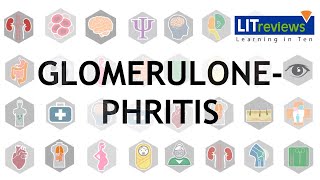 Glomerulonephritis [upl. by Dnalerb613]