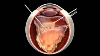 Retina  Few Important Points  Part 3 [upl. by Notrom]