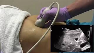 How I do it Ultrasound of the Abdomen [upl. by Loriner]