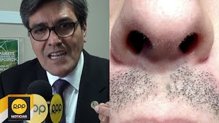 ¿Cómo parar una hemorragia nasal correctamente│RPP [upl. by Lesser938]