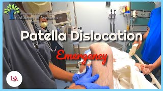 Patella Dislocation Emergency [upl. by Worrad]