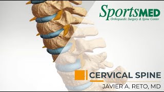 CERVICAL RADICULOPATHY Common Symptoms and Treatment Options  Dr Javier Reto [upl. by Harriot]