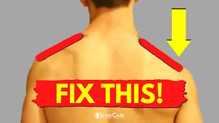 Understanding Shoulder Pain and How To Fix It [upl. by Ecirtnas806]