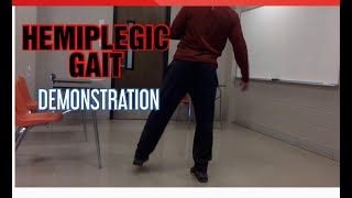 HEMIPLEGIC GAITGAIT DEMONSTRATION [upl. by Etom]