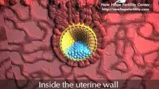 Embyro Implantation [upl. by Ecilahs]