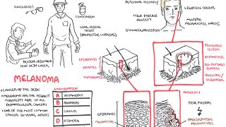 Introduction to Skin Cancer 3 Overview of Nevi and Melanoma [upl. by Nillek]