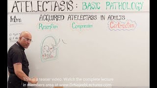 Atelectasis  Resorption Compression and Contraction [upl. by Anillehs]