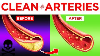 Supplements amp Herbs to Unclog Arteries Increase Oxygen  Dr Mandell [upl. by Eidroj]