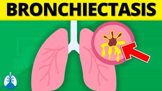 Bronchiectasis Medical Definition  Quick Explainer Video [upl. by Enineg]