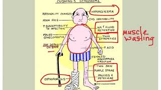 Endocrine Disorders [upl. by Ydniahs]