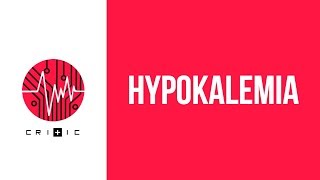 Hypokalemia  an easy workup [upl. by Ainolopa]