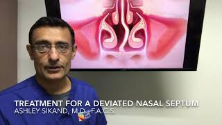 Treatment For A Deviated Nasal Septum [upl. by Mayda]