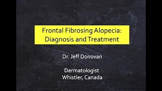 Frontal Fibrosing Alopecia FFA Diagnosis amp Treatment [upl. by Cissy]