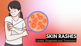 Skin Rash Causes Signs and Symptoms Diagnosis and Treatment [upl. by Anawk]