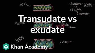 Transudate vs exudate  Respiratory system diseases  NCLEXRN  Khan Academy [upl. by Nangatrad]