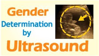 Gender Determination by Ultrasound [upl. by Carlyle]