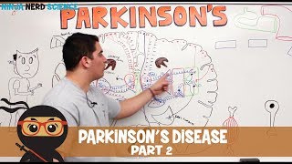 Chronic Ischemic Heart Disease  Pathology USMLE Step 1 [upl. by Ecylla827]