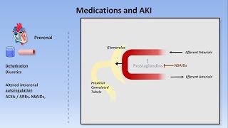 CT Kidneys and Bladder  Five pathologic cases discussed [upl. by Ronacin463]