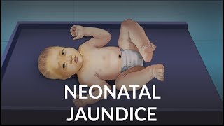 Neonatal Jaundice by L Veit  OPENPediatrics [upl. by Nele]