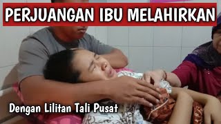 PROSES MELAHIRKAN NORMAL ANAK PERTAMA  DENGAN LILITAN TALI PUSAT [upl. by Unders]