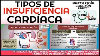 INSUFICIENCIA CARDÍACA DERECHA E IZQUIERDA FISIOPATOLOGÍA  GuiaMed [upl. by Jepum820]