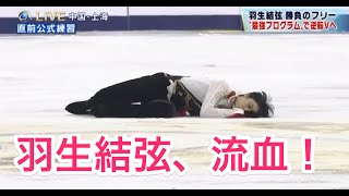 羽生結弦、流血！ 中国選手との衝突の瞬間！！ [upl. by Raffin]