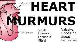 Heart Murmurs  Locations Maneuvers Buzzwords [upl. by Ecienal]