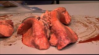 Lung inflation in HD video [upl. by Dnomyad]