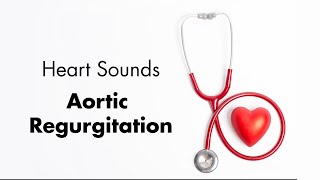 Aortic Regurgitation  Heart Sounds  MEDZCOOL [upl. by Ostraw]