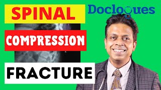 What Is Spinal Compression Fracture [upl. by Erdnael]