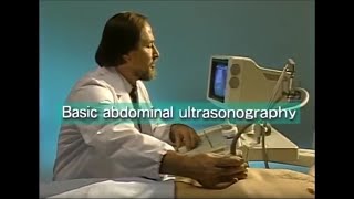 How to do abdominal ultrasound examination [upl. by Cross]