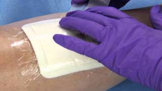 3M™ Tegaderm™ Foam Adhesive Dressing  Application and Removal [upl. by Ajani757]