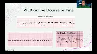 EKGVentricular Dysrhythmias [upl. by Luar]