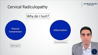 Cervical Radiculopathy  Why do you hurt and what is the plan to get you better [upl. by Schramke]