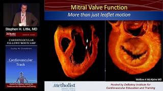 Mitral Stenosis Stephen H Little MD Sunday August 21 2016 [upl. by Wallack368]