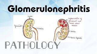 Glomerulonephritis Pathology [upl. by Noedig]