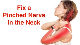 Fix a Pinched Nerve in the Neck With FREE Exercise Sheet [upl. by Janeva]