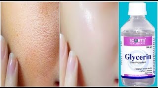 Use Glycerin This Way Your Skin Will Look So Young Tight Spotless amp Scar Free [upl. by Gavriella]