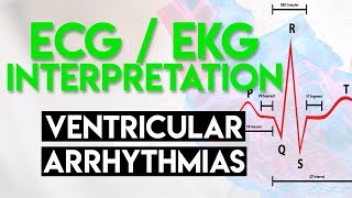 Ventricular Arrhythmias  ECG EKG Interpretation Part 5 [upl. by Carree247]